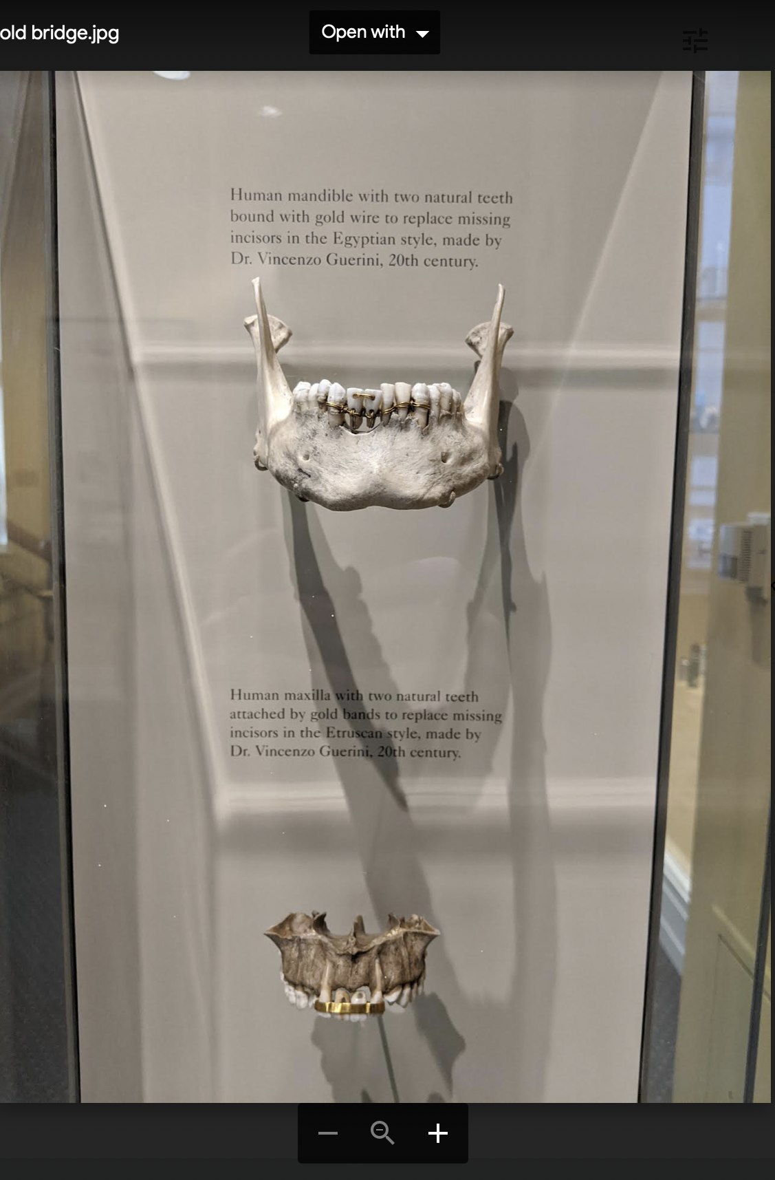 Fact Check This Photo Is NOT Ancient Egyptian Dentistry This Dental